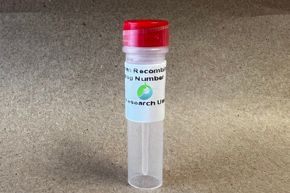 Recombinant Human ACE2 Protein (C-hFc)