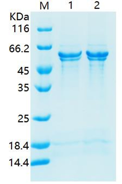 Recombinant Human Cellular Tumor Antigen p53 (N-His)