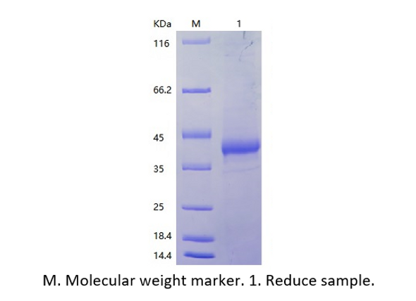 Recombinant Human Interleukin-2 Receptor Subunit Beta/IL2RB (N-Avi&His)