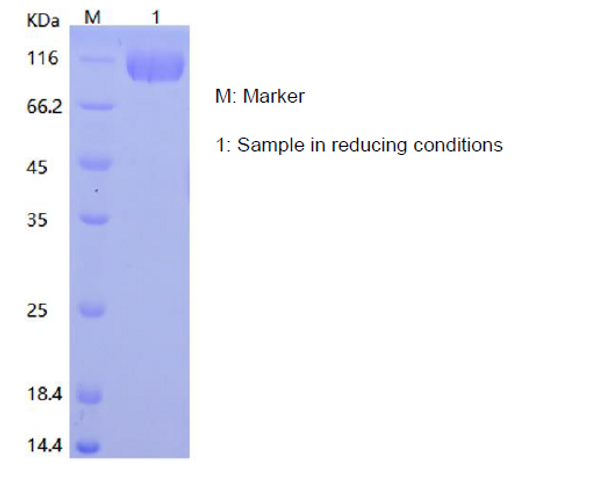 Recombinant Human Siglec-2/CD22 (C-His)