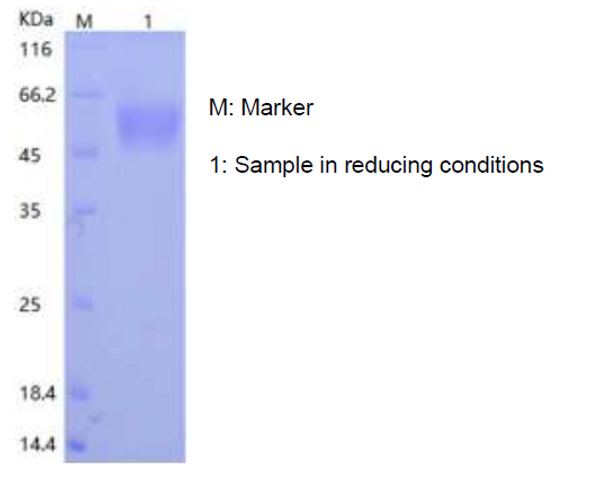 Recombinant Human IL-3R alpha/CD123 (C-His)