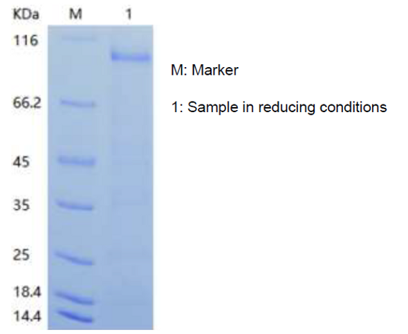 Recombinant Human Lysyl Oxidase Homolog 2/LOXL2 (N-His)