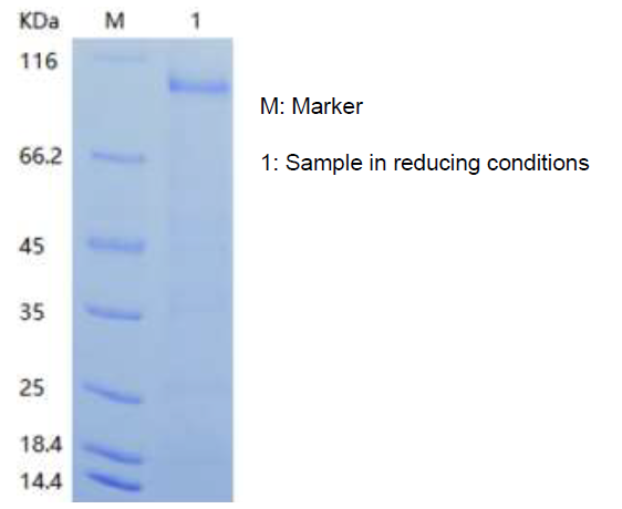 Recombinant Human Lysyl Oxidase Homolog 2/LOXL2 (N-His)