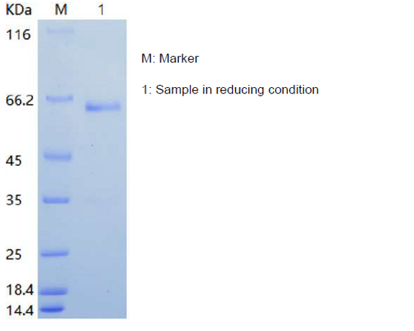 Recombinant Human Insulin-like Growth Factor Binding Protein 2/IGFBP2 (C-hFc)