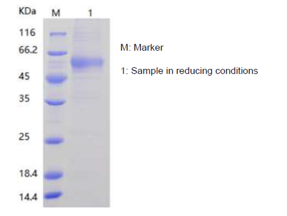 Recombinant Human Osteoprotegerin/OPG/TNFRSF11B (C-His)