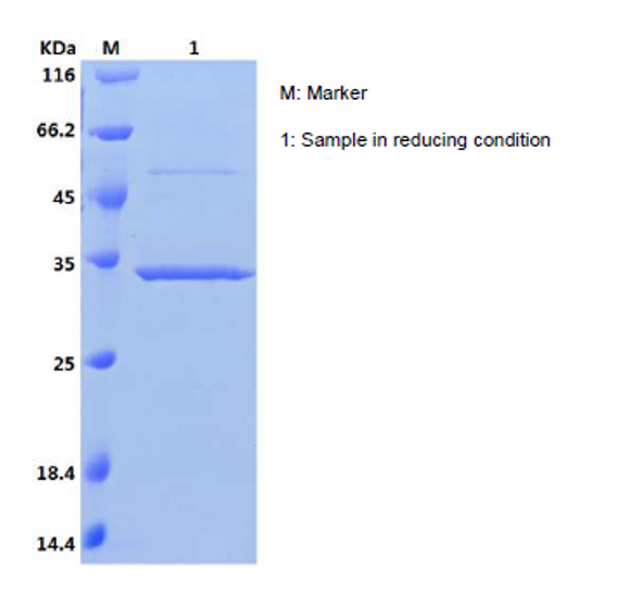 Recombinant Human Syncoilin/SYNC