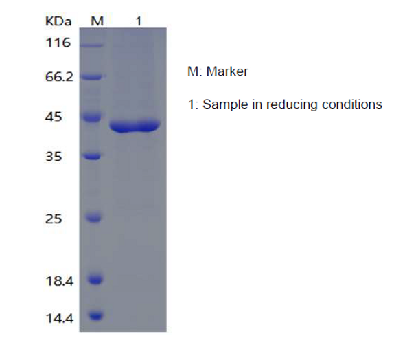 Recombinant Human Chitinase-3-Like Protein 1/CHI3L1 (C-His)
