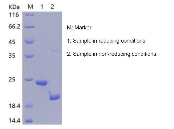 Recombinant Human Retinol-Binding Protein 4/RBP4 (C-His)