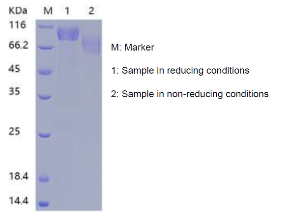 Recombinant Human E-selectin/ELAM1/CD62E (C-His)