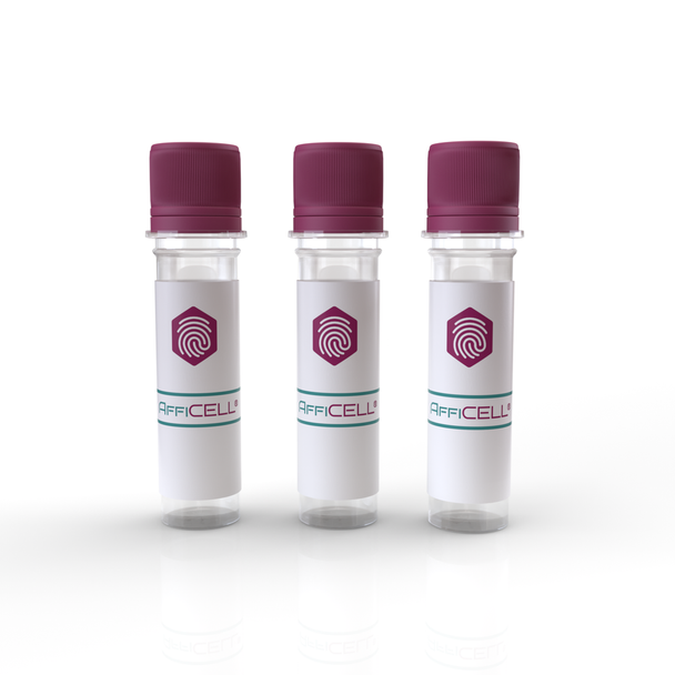 AffiCELL® Human Esophageal Squamous Cancer Cells