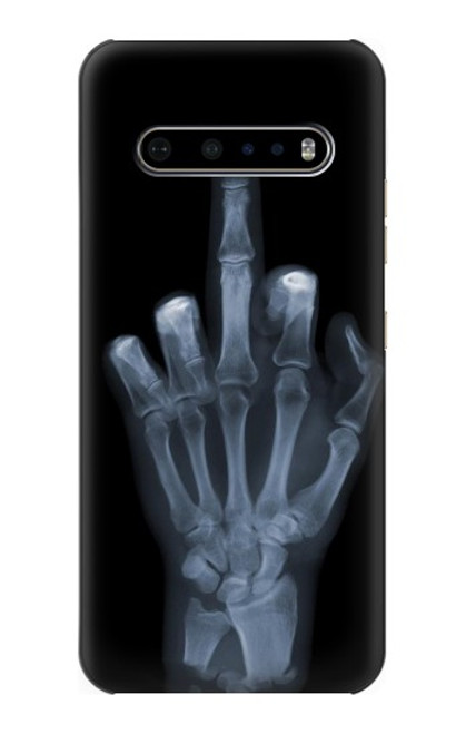 S1143 X-ray Hand Middle Finger Case For LG V60 ThinQ 5G