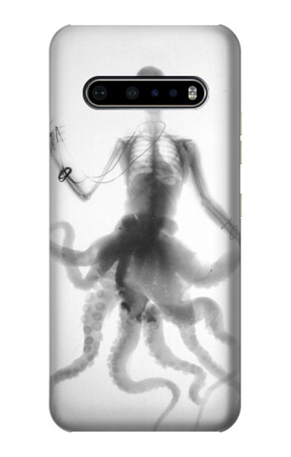 S1432 Skull Octopus X-ray Case For LG V60 ThinQ 5G