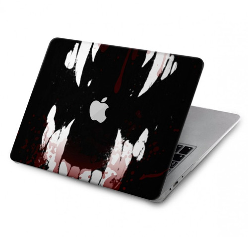 S3527 Vampire Teeth Bloodstain Hard Case For MacBook Pro 15″ - A1707, A1990