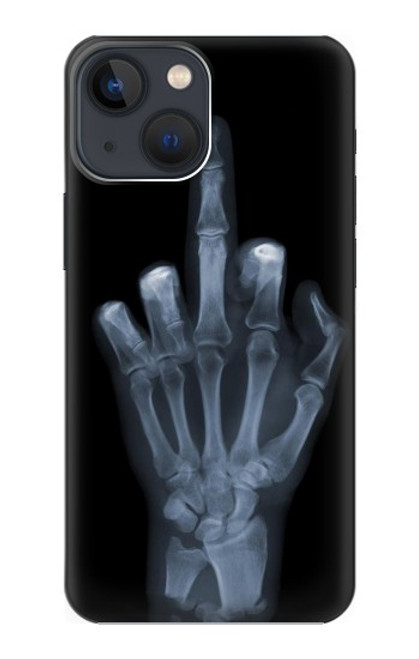 S1143 X-ray Hand Middle Finger Case For iPhone 13