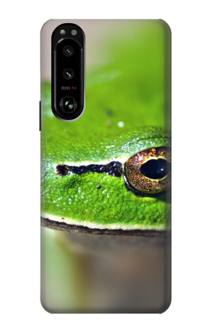 S3845 Green frog Case For Sony Xperia 5 III