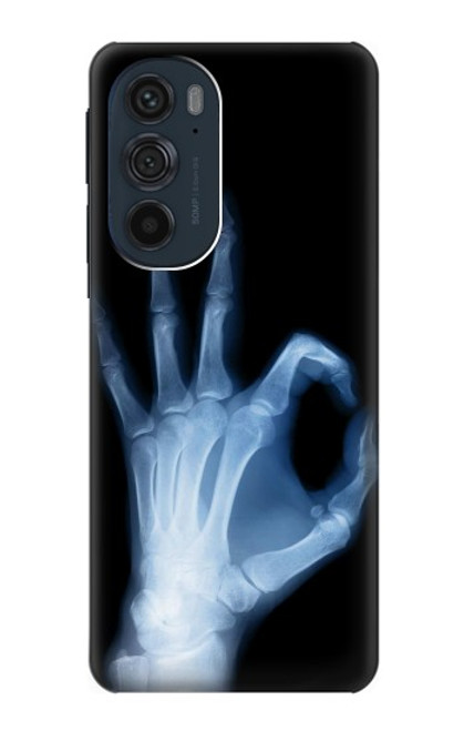 S3239 X-Ray Hand Sign OK Case For Motorola Edge 30 Pro