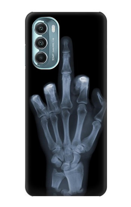 S1143 X-ray Hand Middle Finger Case For Motorola Moto G Stylus 5G (2022)