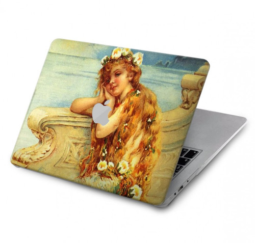 S3184 Little Mermaid Painting Hard Case For MacBook Air 13″ (2022,2024) - A2681, A3113