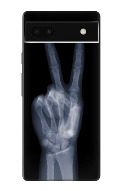 S3101 X-ray Peace Sign Fingers Case For Google Pixel 6a