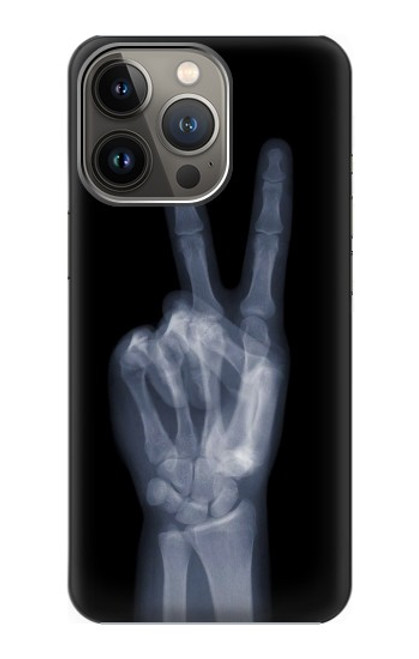 S3101 X-ray Peace Sign Fingers Case For iPhone 14 Pro Max