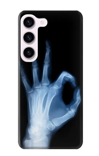 S3239 X-Ray Hand Sign OK Case For Samsung Galaxy S23