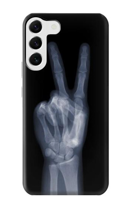 S3101 X-ray Peace Sign Fingers Case For Samsung Galaxy S23 Plus