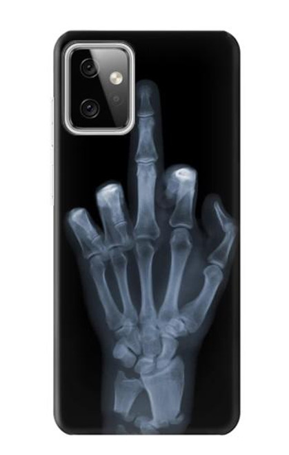 S1143 X-ray Hand Middle Finger Case For Motorola Moto G Power (2023) 5G