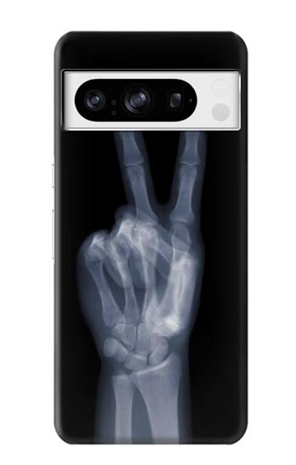 S3101 X-ray Peace Sign Fingers Case For Google Pixel 8 pro