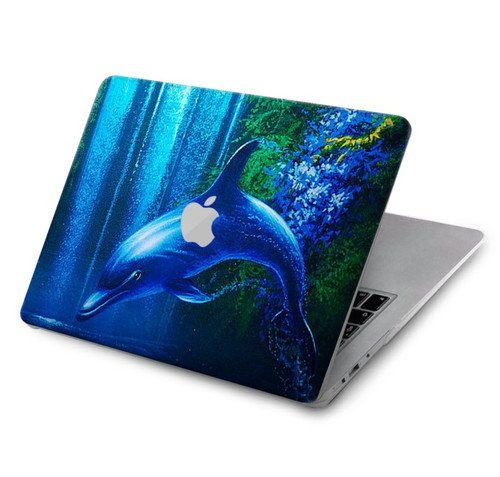 S0385 Dolphin Hard Case For MacBook Air 15″ (2023,2024) - A2941, A3114