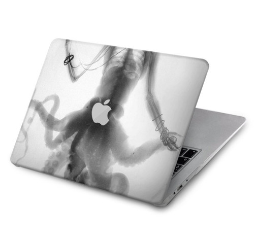 S1432 Skull Octopus X-ray Hard Case For MacBook Air 15″ (2023,2024) - A2941, A3114
