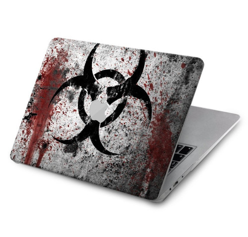 S2440 Biohazards Biological Hazard Hard Case For MacBook Air 15″ (2023,2024) - A2941, A3114