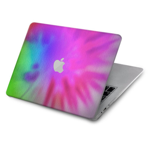 S2488 Tie Dye Color Hard Case For MacBook Air 15″ (2023,2024) - A2941, A3114