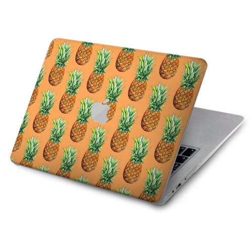 S3258 Pineapple Pattern Hard Case For MacBook Air 15″ (2023,2024) - A2941, A3114