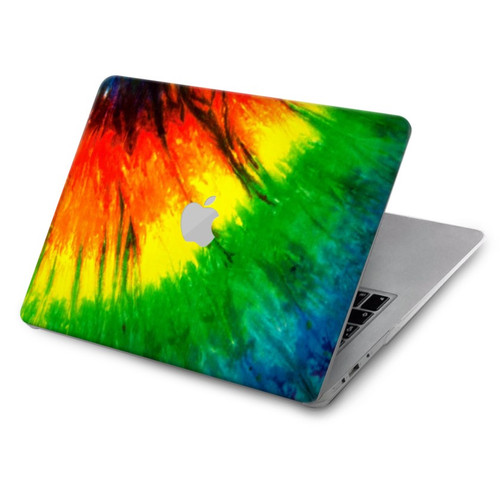 S3422 Tie Dye Hard Case For MacBook Air 15″ (2023,2024) - A2941, A3114