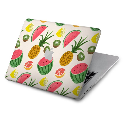 S3883 Fruit Pattern Hard Case For MacBook Air 15″ (2023,2024) - A2941, A3114