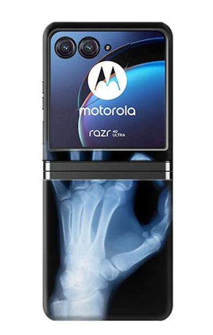 S3239 X-Ray Hand Sign OK Case For Motorola Razr 40 Ultra