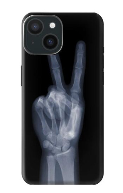 S3101 X-ray Peace Sign Fingers Case For iPhone 15