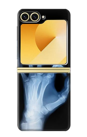 S3239 X-Ray Hand Sign OK Case For Samsung Galaxy Z Flip 6, Flip 7 FE