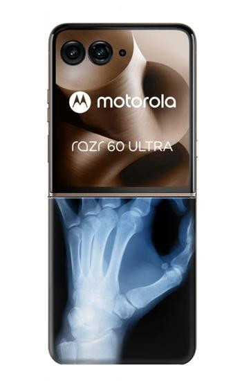 S3239 X-Ray Hand Sign OK Case For Motorola Razr 70 Ultra, 60 Ultra, 50 Ultra, Ultra 2026, Ultra 2025