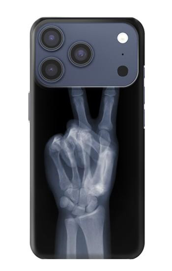 S3101 X-ray Peace Sign Fingers Case For iPhone 17 Pro, 18 Pro