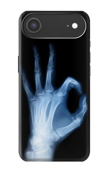 S3239 X-Ray Hand Sign OK Case For iPhone Air