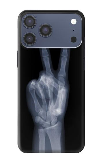 S3101 X-ray Peace Sign Fingers Case For iPhone 17 Pro Max, 18 Pro Max