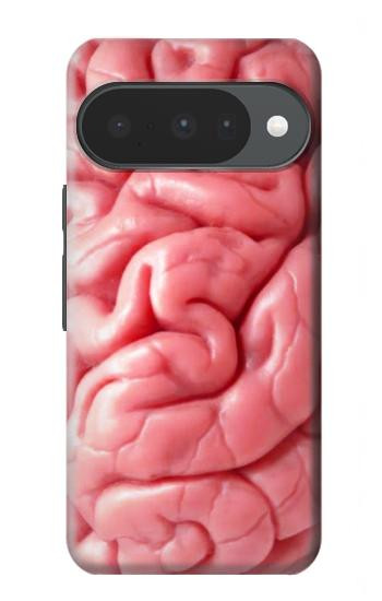 S0339 Brain Case For Google Pixel 10, 10 Pro