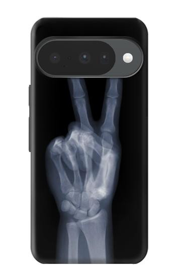 S3101 X-ray Peace Sign Fingers Case For Google Pixel 10, 10 Pro