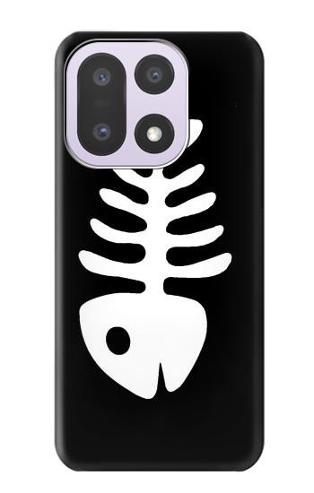 S2509 Fishbone Case For OnePlus 15