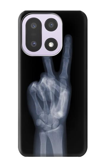 S3101 X-ray Peace Sign Fingers Case For OnePlus 15