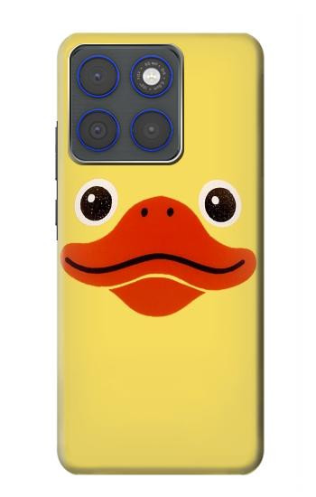 S1922 Duck Face Case For Motorola Edge 70