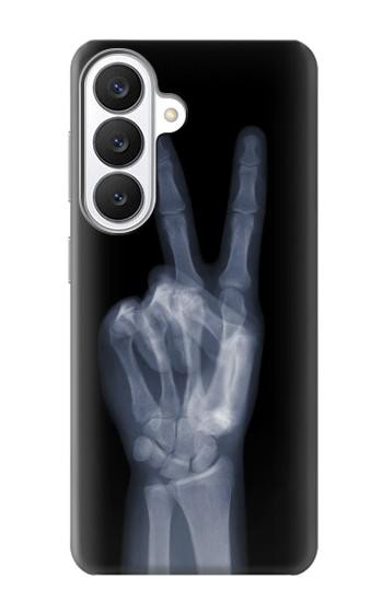 S3101 X-ray Peace Sign Fingers Case For Samsung Galaxy S26
