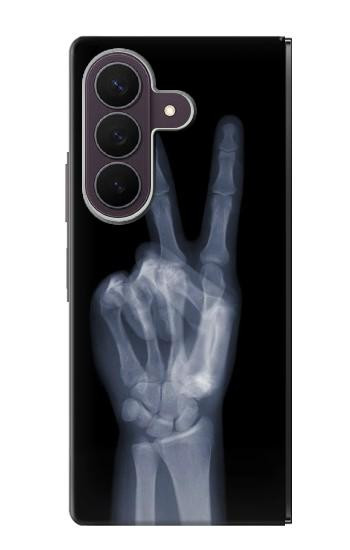 S3101 X-ray Peace Sign Fingers Case For Samsung Galaxy Z Fold 8 Ultra