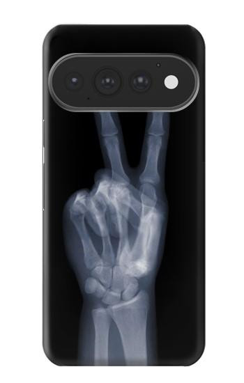 S3101 X-ray Peace Sign Fingers Case For Google Pixel 11, 11 Pro